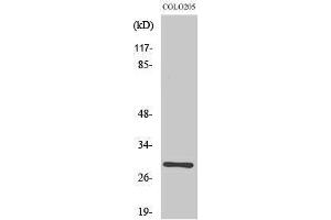 Western Blotting (WB) image for anti-RAB6C (WTH3DI) (Internal Region) antibody (ABIN3186631) (WTH3DI anticorps  (Internal Region))