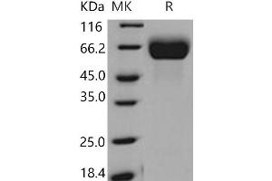 Western Blotting (WB) image for Fibroblast Growth Factor Receptor 1 (FGFR1) protein (His tag) (ABIN7320381) (FGFR1 Protein (His tag))