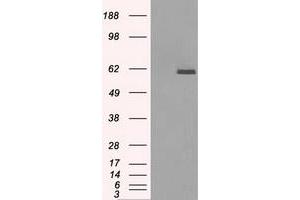 HEK293T cells were transfected with the pCMV6-ENTRY control (Left lane) or pCMV6-ENTRY PPP5C (Right lane) cDNA for 48 hrs and lysed. (PP5 anticorps)