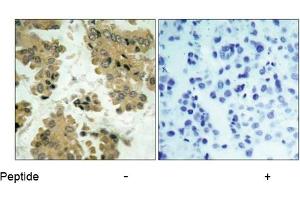 Image no. 1 for anti-V-Akt Murine Thymoma Viral Oncogene Homolog 2 (AKT2) (Ser474) antibody (ABIN197359) (AKT2 anticorps  (Ser474))