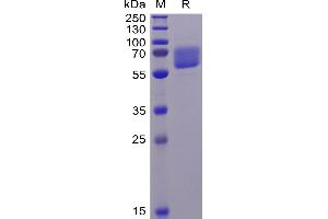 Human AXL Protein, His Tag on SDS-PAGE under reducing condition. (AXL Protein (AA 26-449) (His tag))