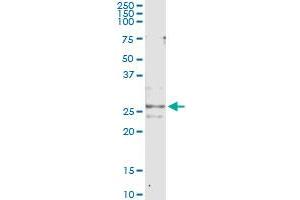 Immunoprecipitation of CFC1 transfected lysate using anti-CFC1 monoclonal antibody and Protein A Magnetic Bead , and immunoblotted with CFC1 MaxPab rabbit polyclonal antibody. (CFC1 anticorps  (AA 27-93))