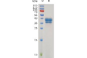 Human (1-21) Protein, hFc Tag on SDS-PAGE under reducing condition. (GPR55 Protein (AA 1-21) (Fc Tag))