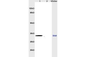 SDS-PAGE (SDS) image for anti-ATG5 Autophagy Related 5 (ATG5) (AA 101-200) antibody (ABIN752413)