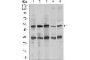 Western blot analysis using CHGA antibody against MOLT4 (1), SK-N-SH (2), HepG2 (3), PC-12 (4), and C6 (5) cell lysate. (Chromogranin A anticorps  (AA 87-252))