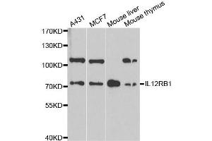 Western Blotting (WB) image for anti-Interleukin 12 Receptor beta 1 (IL12RB1) antibody (ABIN1980210) (IL12RB1 anticorps)