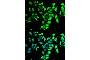 Immunofluorescence analysis of A549 cells using FKBP8 antibody. (FKBP8 anticorps)