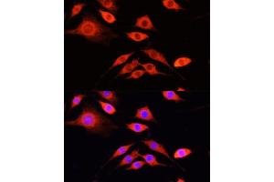 Immunofluorescence analysis of PC-12 cells using SERPIN antibody  at dilution of 1:100 (40x lens). (SERPINA10 anticorps  (AA 165-444))