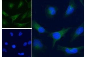 IF/ICC staining of human HeLa cells with Alexa Fluor 488 secondary, and GAPDH antibody at 5ug/ml (blue = DAPI nuclear counterstain). (GAPDH anticorps)