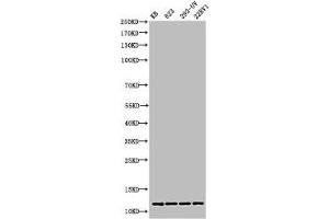 Western Blot analysis of KB 823 293-UV 22RV1 cells using Acetyl-Histone H4 (K16) Polyclonal Antibody (HIST1H4A anticorps  (acLys16))