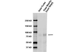 Western blot analysis of Rat kidney tissue lysates showing detection of ENaC protein using Rabbit Anti-ENaC Polyclonal Antibody . (SCNN1A anticorps  (AA 46-68) (Atto 488))