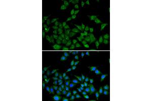 Immunofluorescence analysis of HeLa cells using DIDO1 antibody (ABIN5973852). (DIDO1 anticorps)