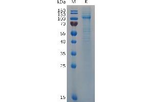 Human VWF (23-763) Protein, His Tag on SDS-PAGE under reducing condition. (VWF Protein (AA 23-763) (His tag))