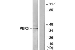 Western blot analysis of extracts from Jurkat cells, treated with insulin (0. (PER3 anticorps  (N-Term))