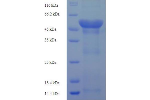 FBXL18 Protein (AA 1-365, Isoform 3) (His-SUMO Tag)