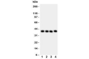 Western blot testing of CD34 antibody and Lane 1:  MCF-7;  2: MM231;  3: SMMC-7721;  4: HepG2 lysate. (CD34 anticorps  (AA 151-385))