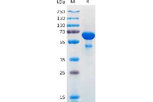 Human L1 Protein, hFc Tag on SDS-PAGE under reducing condition. (BCL2L1 Protein (AA 1-212) (Fc Tag))