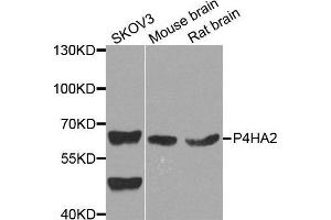 Western Blotting (WB) image for anti-Prolyl 4-Hydroxylase, alpha Polypeptide II (P4HA2) (AA 234-533) antibody (ABIN6220566) (P4HA2 anticorps  (AA 234-533))