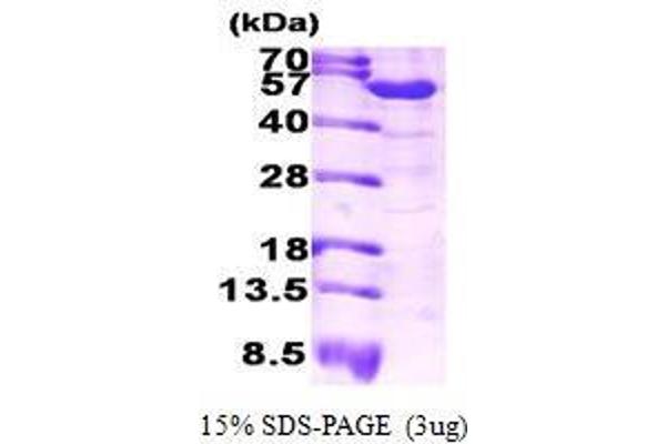 ALDH1A1 Protein (AA 1-501)