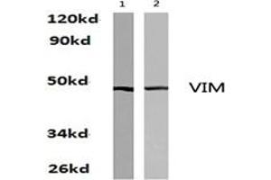 Image no. 1 for anti-Vimentin (VIM) antibody (ABIN271977) (Vimentin anticorps)