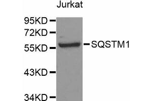 Western blot analysis of extracts of Jurkat cells, using SQSTM1 antibody (ABIN5998954) at 1/1000 dilution. (SQSTM1 anticorps)