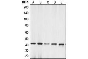 Western blot analysis of Gamma-actin-1 expression in HeLa (A), Raw264. (gamma-Actin-1 (C-Term) anticorps)