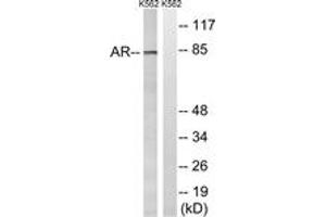 Western Blotting (WB) image for anti-Androgen Receptor (AR) (AA 331-380) antibody (ABIN2889124) (Androgen Receptor anticorps  (AA 331-380))