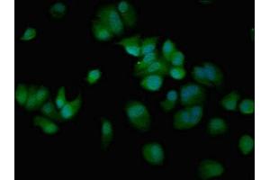 Immunofluorescent analysis of MCF-7 cells using ABIN7148671 at dilution of 1:100 and Alexa Fluor 488-congugated AffiniPure Goat Anti-Rabbit IgG(H+L) (CBP anticorps  (AA 2217-2442))