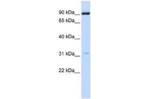 Western Blot showing CHRNA4 antibody used at a concentration of 1-2 ug/ml to detect its target protein. (CHRNA4 anticorps  (N-Term))