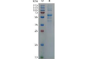 SARS-CoV-2 (2019-nCoV) S protein RBD (G339D, S371L, S373P, S375F, K417N, N440K, G446S, S477N, T478K, E484A, Q493R, G496S, Q498R, N501Y, Y505H), hFc Tag on SDS-PAGE under reducing condition. (SARS-CoV-2 Spike Protein (RBD) (Fc Tag))