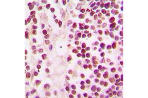 Immunohistochemical analysis of CBP staining in human tonsil formalin fixed paraffin embedded tissue section. (CBP anticorps  (C-Term))