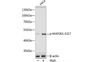 Western blot analysis of extracts of various cell lines using Phospho-MAP2K1(S217) Polyclonal Antibody at dilution of 1:1000. (MEK1 anticorps  (pSer217))