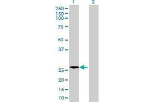 Lane 1: THEM4 transfected lysate ( 26. (THEM4 293T Cell Transient Overexpression Lysate(Denatured))