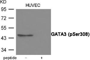 Western blot analysis of extracts from HUVEC cells using GATA3 (Phospho-Ser308) Antibody. (GATA3 anticorps  (pSer308))