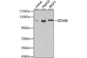 Western blot analysis of extracts of various cell lines, using DDX58 antibody. (DDX58 anticorps)