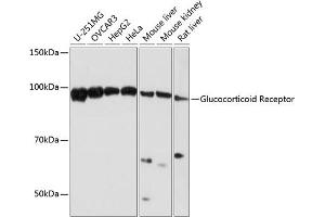 Western blot analysis of extracts of various cell lines, using Glucocorticoid Receptor antibody (ABIN7269016) at 1:1000 dilution. (Glucocorticoid Receptor anticorps)