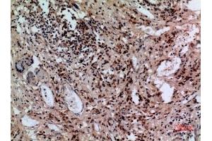 Immunohistochemical analysis of paraffin-embedded human-lung, antibody was diluted at 1:100. (SLC10A1 anticorps  (C-Term))