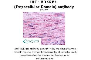 Image no. 1 for anti-Bradykinin Receptor B1 (BDKRB1) (2nd Extracellular Domain) antibody (ABIN1732269) (BDKRB1 anticorps  (2nd Extracellular Domain))