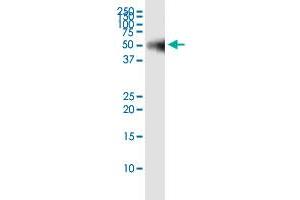 Immunoprecipitation of PPM1F transfected lysate using rabbit polyclonal anti-PPM1F and Protein A Magnetic Bead ( U0007 ), and immunoblotted with mouse purified polyclonal anti-PPM1F. (PPM1F (Humain) IP-WB Antibody Pair)