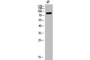 Western Blot analysis of KB cells using Phospho-PI 3-kinase p85α (Y607) Polyclonal Antibody (PIK3R1 anticorps  (pTyr607))