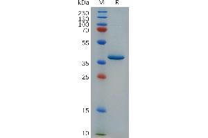 Cynomolgus C Protein, hFc Tag on SDS-PAGE under reducing condition. (PF4 Protein (AA 34-101) (Fc Tag))