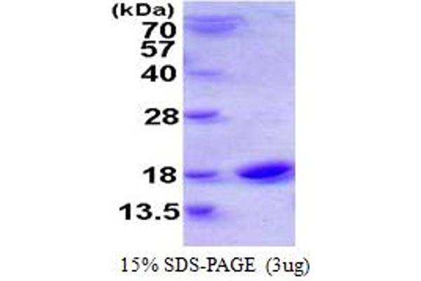 CST1 Protein (AA 21-141) (His tag)