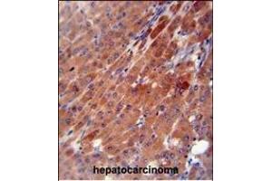 Immunohistochemistry (Paraffin-embedded Sections) (IHC (p)) image for anti-Carboxylesterase 2 (CES2) (AA 340-369) antibody (ABIN654618)