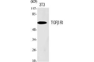 Western Blot analysis of various cells using TGFβ RI Polyclonal Antibody diluted at 1:500. (TGFBR1 anticorps)