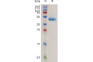 Human R(21-146) Protein, hFc Tag on SDS-PAGE under reducing condition. (RSPO1 Protein (AA 21-146) (Fc Tag))