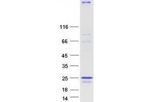 Validation with Western Blot (NINJ2 Protein (Myc-DYKDDDDK Tag))