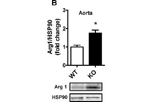 Western Blotting (WB) image for anti-Arginase, Liver (ARG1) antibody (ABIN2856661)