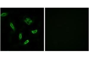 Immunofluorescence analysis of A549 cells, using SLC27A5 Antibody. (SLC27A5 anticorps  (AA 481-530))