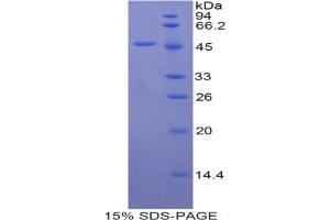 SDS-PAGE analysis of Mouse FGF10 Protein. (FGF10 Protéine)