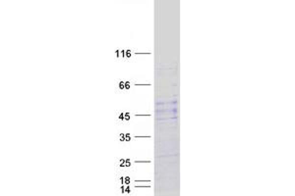 NOTUM Protein (Myc-DYKDDDDK Tag)